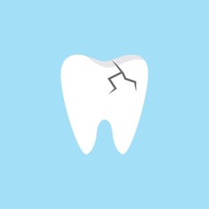 Signs of a Fractured Tooth