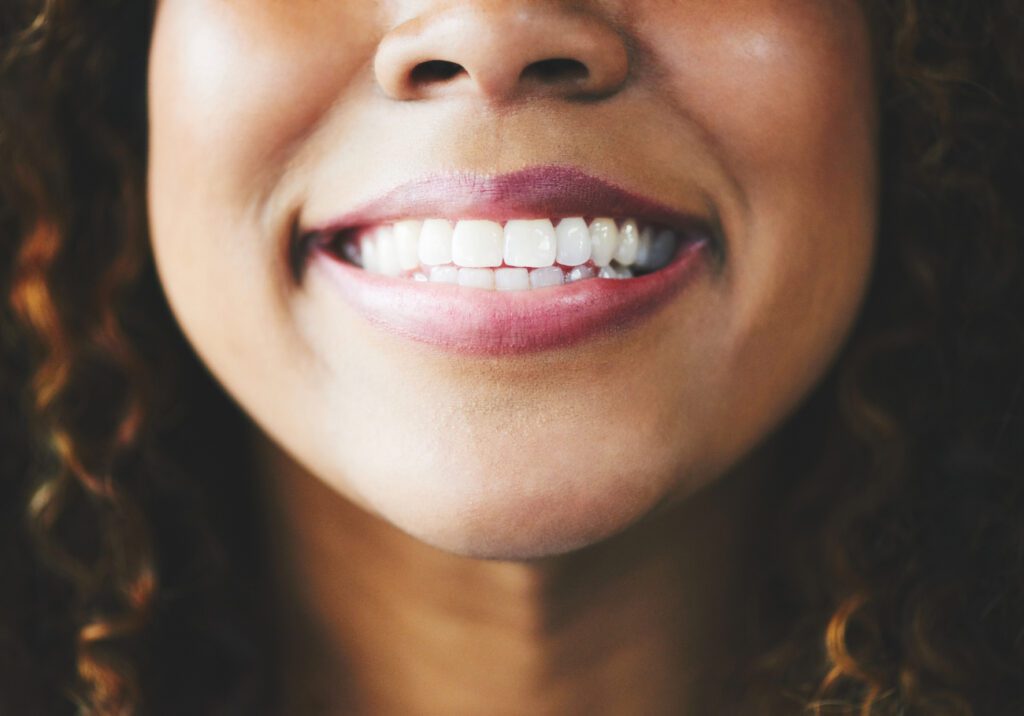 Unlock a Brighter Smile with Teeth Whitening